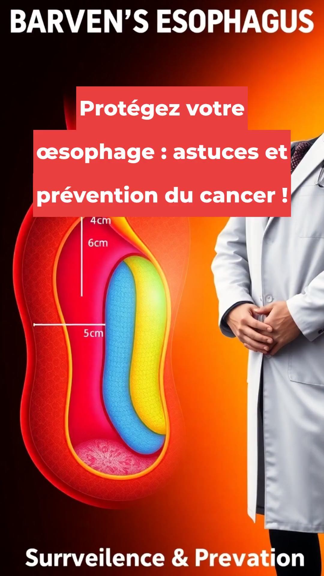 Protégez votre œsophage : astuces et prévention du cancer !