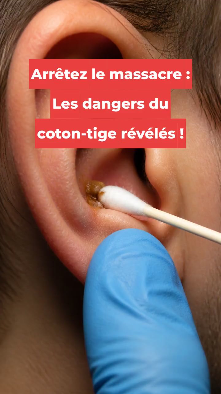 Arrêtez le massacre : Les dangers du coton-tige révélés !