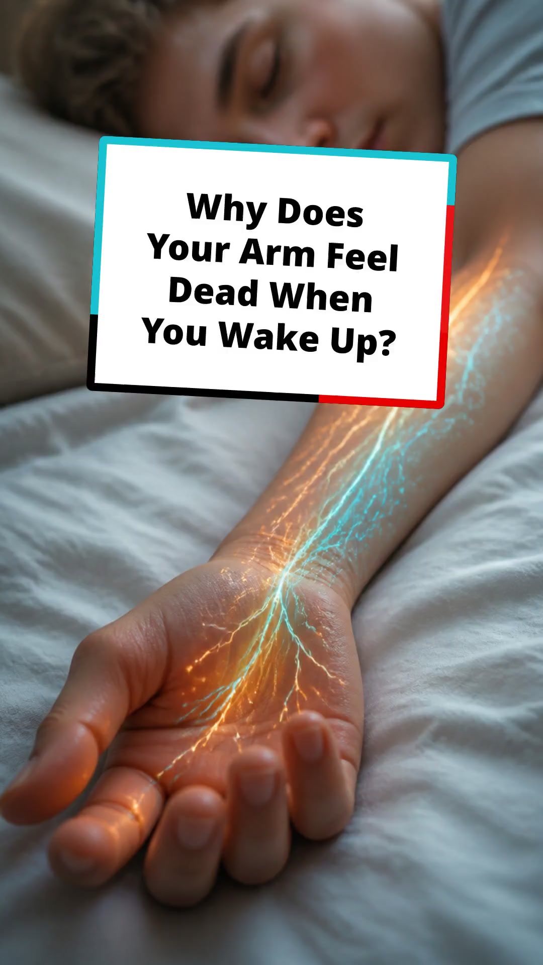 Why Does Your Arm Feel Dead When You Wake Up?