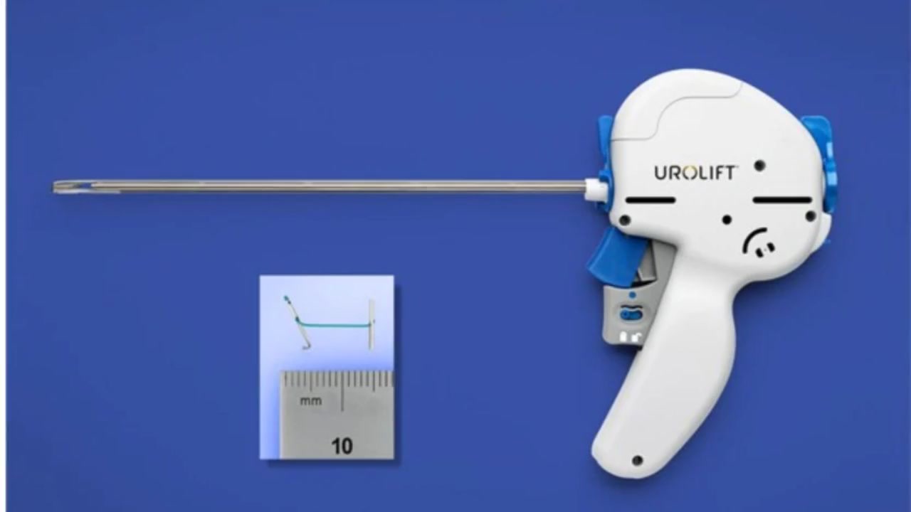 Urolift : Tout ce que vous devez savoir avant de décider !