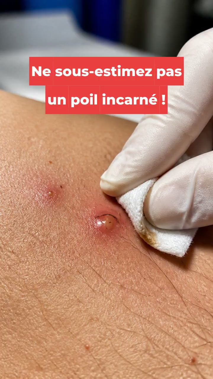 Ne sous-estimez pas un poil incarné !