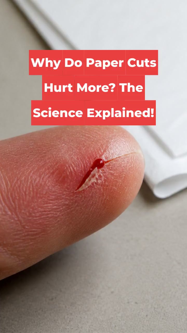 Why Do Paper Cuts Hurt More? The Science Explained!
