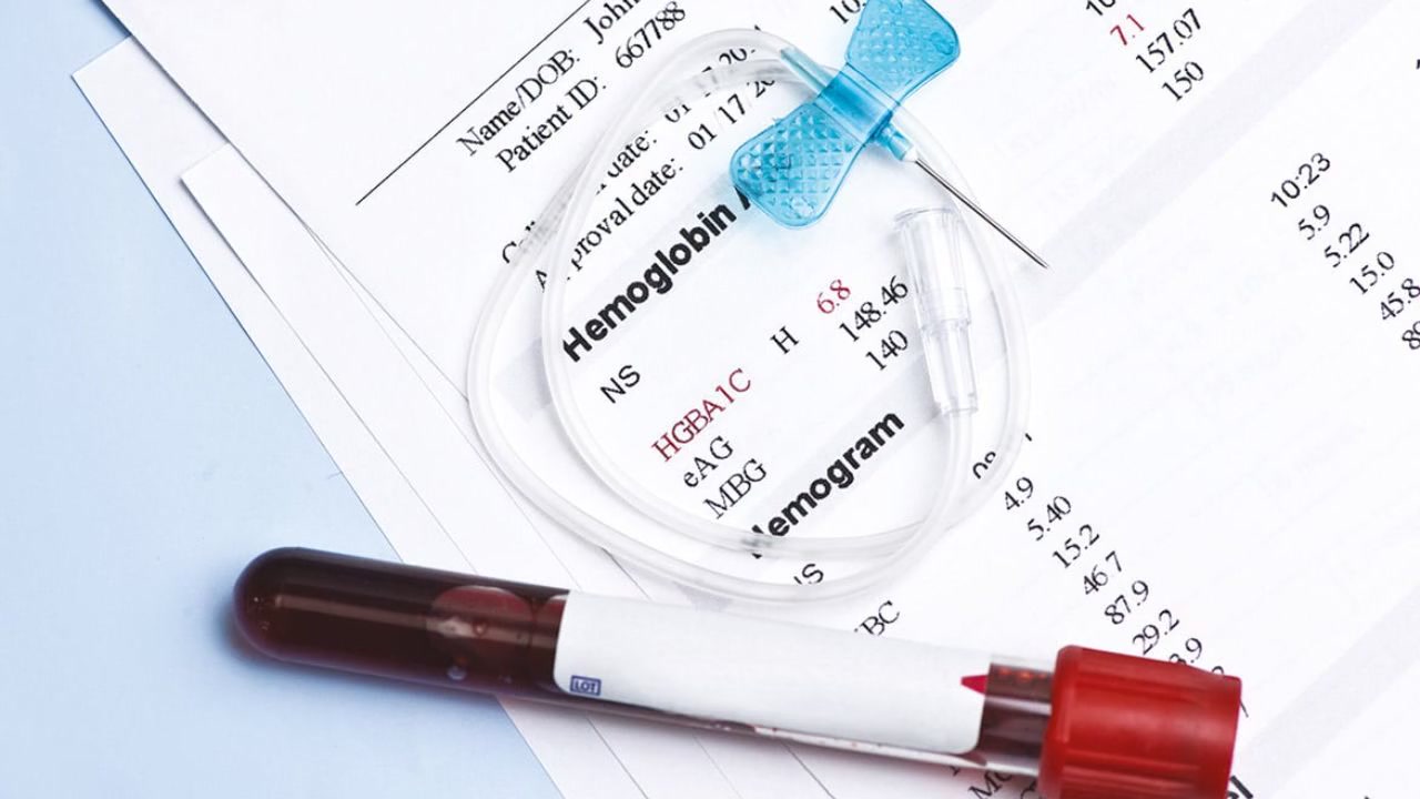 Tout savoir sur l'HbA1c : 8 éléments cruciaux à découvrir !